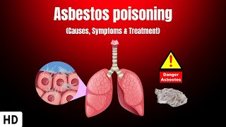 Asbestos Health Risks Explained [upl. by Akiehs]