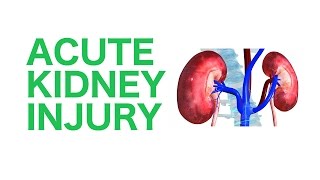 Acute Kidney Injury AKI  USMLE [upl. by Airad590]