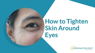 How to Tighten Skin Around Eyes  Reduce Wrinkles [upl. by Adnyleb]