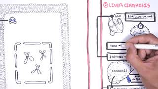 Hyponatraemia Hyponatremia  classification causes pathophysiology treatment [upl. by Danella]