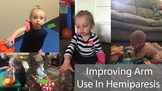 Improving Arm Use In Hemiparesis [upl. by Vernita]