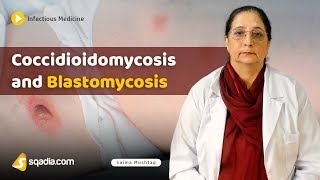 Coccidioidomycosis and Blastomycosis  Internal Medicine Infectious Disease  VLearning [upl. by Sandler]