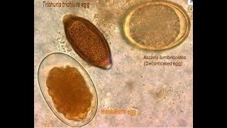 parasites seen from the microscope [upl. by Wahkuna]