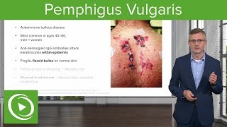 Pemphigus Vulgaris – Dermatology  Lecturio [upl. by Dominik922]