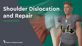 Shoulder Replacement surgery and recovery [upl. by Carree]