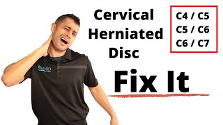 Cervical herniated disc exercises [upl. by Janicki]