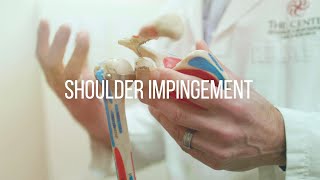 Shoulder Impingement Causes and Treatment [upl. by Ridan]