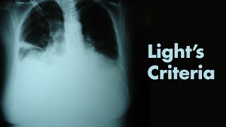 Lights Criteria amp Pleural Effusions  MEDZCOOL [upl. by Atims]