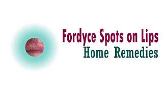 Fordyce Spots on Lips Home Remedies [upl. by Nnyleimaj238]