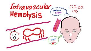 Intravascular Hemolysis [upl. by Nylannej]