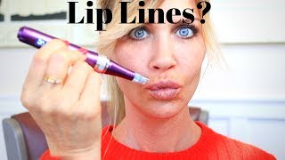 Lip Filler Massage and how to fix Bumps [upl. by Yeorgi]