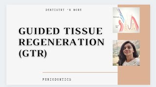 GTR GUIDED TISSUE REGENERATION [upl. by Dowzall]