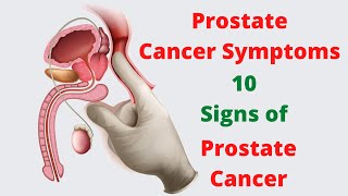 What Is a Normal PSA for a Man Without Prostate Cancer  Ask a Prostate Expert Mark Scholz MD [upl. by Dyke]