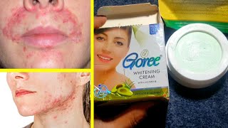 Goree Beauty Cream for Instant Skin Whitening Cream [upl. by Adnimra]