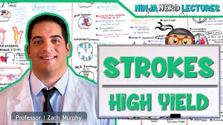 Khan Academy  The Ischemic Cascade in Stroke [upl. by Carmita]