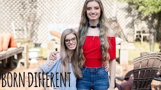 My Identical Twin With Dwarfism  BORN DIFFERENT [upl. by Vtehsta457]