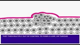 How Cancer Develops amp Mutation [upl. by Enyaz80]