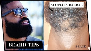 Alopecia explained and Scalp Exam [upl. by Yahska]