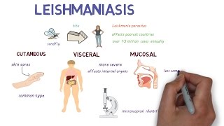 What is Leishmaniasis An introduction and overview [upl. by Dilks467]