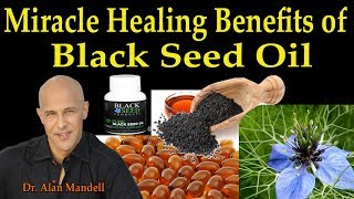 30 Miracle Healing Benefits of Black Seed Oil  Dr Alan Mandell DC [upl. by Tomkiel]