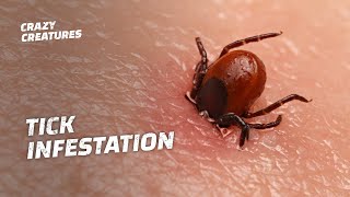 WARNING The Most Horrific Tick Infestations [upl. by Karylin]