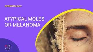 How to remove a mole  Mole causes amp removal  home remedy  Dermatologist  Dr Aanchal Panth [upl. by Goltz]