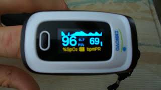 Pulse Oximeter with Atrial Fibrillation Display [upl. by Cibis820]