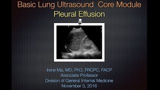 Pleural Effusion [upl. by Ordnajela]