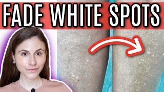 How to FADE WHITE SPOTS from SUN DAMAGE  Dr Dray [upl. by Gaston720]