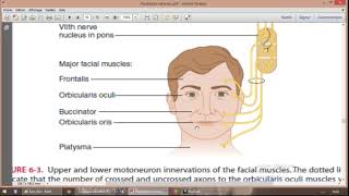 Laryngology 101 What is vocal cord paralysis Part 2 of 2 [upl. by Akers]