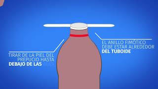 Curar la fimosis sin circuncisión  Phimostop Vídeo [upl. by Sixele]