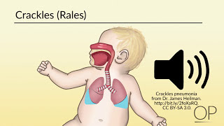 Respiratory Assessment by B Leary L DelSignore  OPENPediatrics [upl. by Uokes]