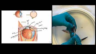 Eye Dissection Instructions [upl. by Denice]