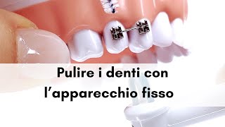 Pulire i denti con l’apparecchio fisso [upl. by Drofdarb23]