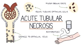 Understanding Acute Tubular Necrosis [upl. by Anivahs]