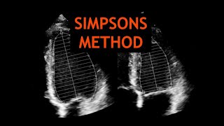 Simpsons Method Echocardiography [upl. by Giarg502]