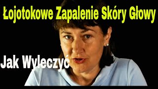 Łojotokowe zapalenie skóry głowy Jak wyleczyć [upl. by Warga324]