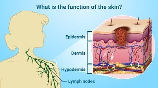 Understanding Melanoma [upl. by Tibbs]