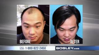 Tired of Losing Your Hair  Bosley Commercial [upl. by Knoll]