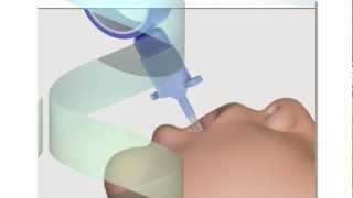 Neonatal Endotracheal Intubation [upl. by Notyard]