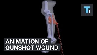 Animation of gunshot wound [upl. by Hilbert]