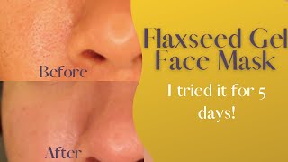 Flaxseed Gel Face Mask  I tried it for 5 days and this happened [upl. by Nidnarb769]