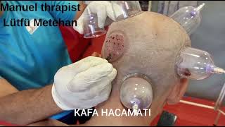 KAFA HACAMATI [upl. by Naga]