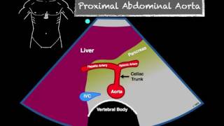 Bedside Ultrasound Abdominal Aorta [upl. by Oiraved]