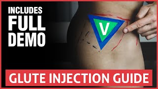 All You Need To Know About Joint Injections [upl. by Duquette]