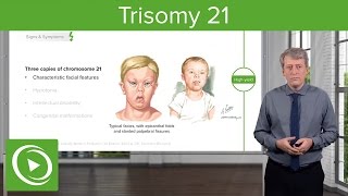 Trisomy 21 Down Syndrome Introduction – Pediatrics  Lecturio [upl. by Selrhc17]