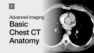 Advanced Imaging Basic Chest CT Anatomy [upl. by Gotthard]