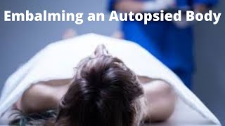 Embalming an autopsied body [upl. by Aniale]