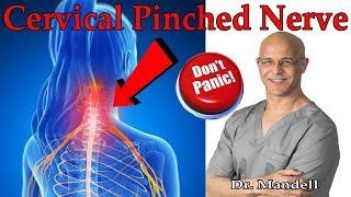 How to Overcome Cervical Pinched Nerve amp Radiculopathy Dont Panic  Dr Alan Mandell DC [upl. by Anayik550]