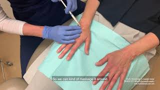 Demo Video Hand Rejuvenation with Radiesse [upl. by Arabela]